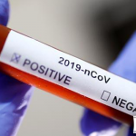 Sağlık Bakanlığı, Yeni Tip Corona Virüsü İle İlgili Sıkça Sorulan Sorulara Cevap Yayınladı